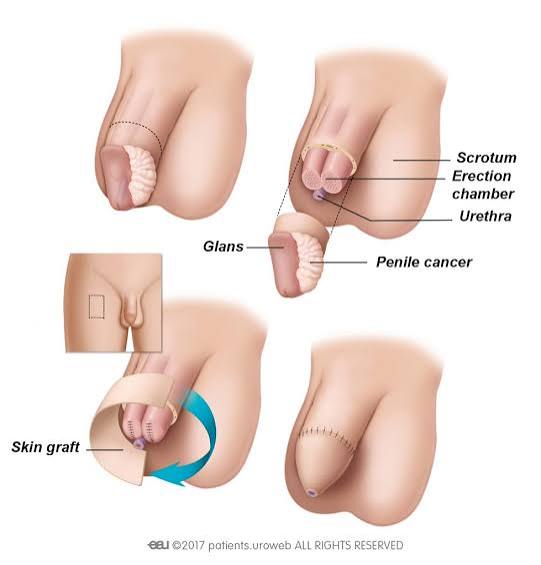 Dr. Avinash Singh Urologist Agra